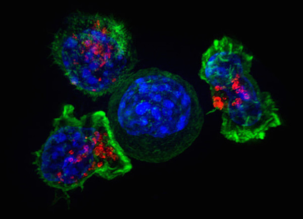CAR-T-Zellen umzingeln Krebszelle (Quelle: Lippincott-Schwarz/NIH) (verweist auf: Forschungszentrum ATMP/Hämatologie)