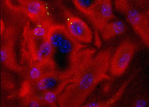 Allergenaufnahme Dendritische Zellen (Quelle: Krause/Paul-Ehrlich-Institut) (verweist auf: Molekulare Allergologie)