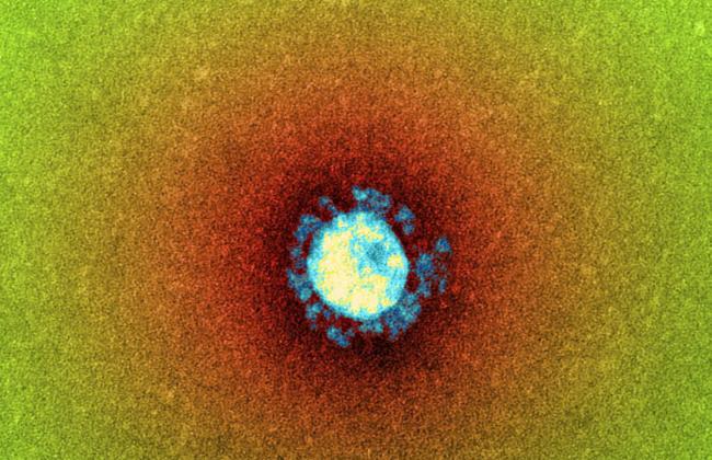 Elektronenmikroskopische Aufnahme eines Coronavirus (SARS) (Quelle: K.Boller/Paul-Ehrlich-Institut)