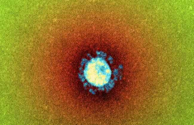 Elektronenmikroskopische Aufnahme eines Coronavirus (SARS) (Quelle: K.Boller/Paul-Ehrlich-Institut) Elektronenmikroskopische Aufnahme eines Coronavirus (SARS) (Quelle: K.Boller/Paul-Ehrlich-Institut)