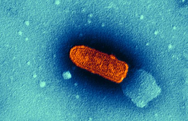 Elektronenmikroskopaufnahme Vesicular stomatitis virus (VSV) (Quelle: K.Boller/Paul-Ehrlich-Institut) Elektronenmikroskopaufnahme Vesicular stomatitis virus (VSV) (Quelle: K.Boller/Paul-Ehrlich-Institut)