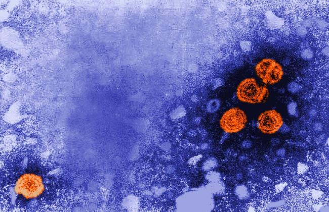 Elektronenmikroskopaufnahme Hepatitis B-Virus (Quelle: CDC/Dr. Erskine Palmer) Elektronenmikroskopaufnahme Hepatitis B-Virus (Quelle: CDC/Dr. Erskine Palmer)