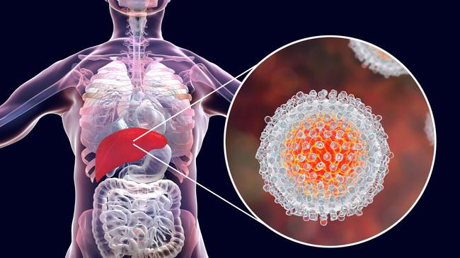 Hepatitis C Virus (Quelle: Kateryna Kon/Shutterstock.com) (verweist auf: Hepatitis-C-Virus-Infektion: Unerwartete provirale Funktion des Guanylat-bindenden Proteins 1 (GBP1) entdeckt)