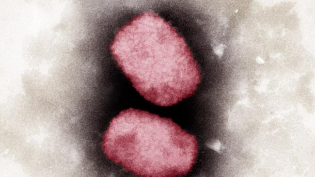 REM-Aufnahme Affenpocken-Virus (Quelle:A.Männel/A.Schnartendorff/Robert-Koch-Institut) (verweist auf: Der CHMP beginnt mit der Prüfung von Daten zur Indikationserweiterung von Imvanex)