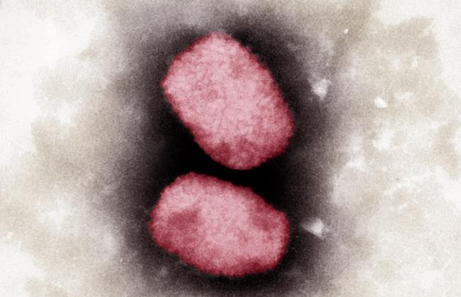 TEM-Aufnahme Affenpocken-Virus (Quelle:A.Männel/A.Schnartendorff/Robert Koch-Institut)