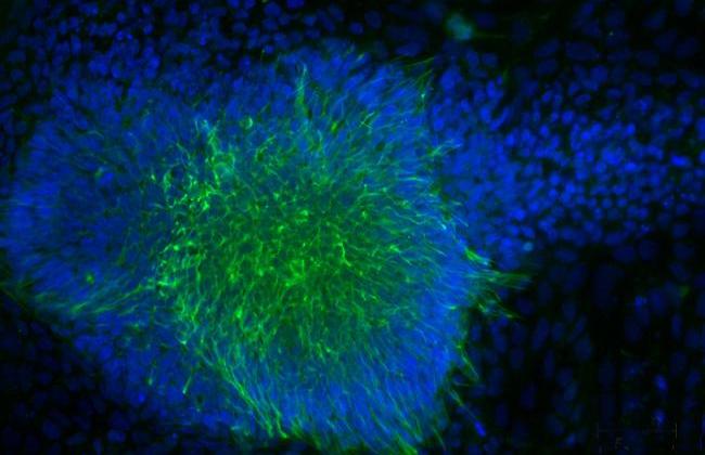 Induzierte pluripotente Stammzellen (Quelle: R.König / Paul-Ehrlich-Institut)