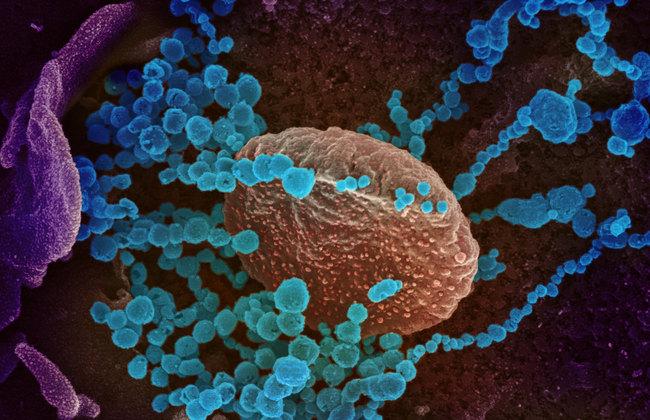 Elektronenmikroskopaufnahme SARS-CoV-2  (Quelle: www.niaid.nih.gov) Elektronenmikroskopaufnahme SARS-CoV-2  (Quelle: www.niaid.nih.gov)