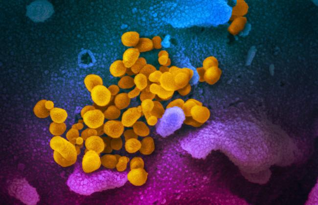 Elektronenmikroskopaufnahme SARS-CoV-2 (Quelle: www.niaid.nih.gov)