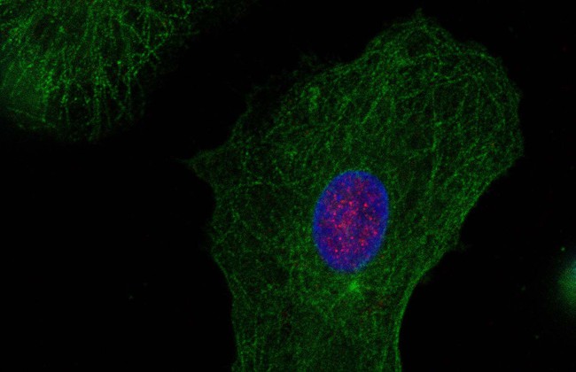 Monozyten-abgeleitete dendritische Zellen (MDDCs) eines gesunden Spenders, gefärbt für PQBP1 (rot) und die zelluläre Strukturkomponente Tubulin-beta (grün). Das Kernkompartiment ist blau gefärbt.