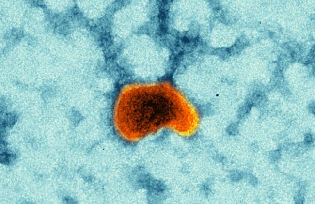  Masernimpfvirus (Quelle: K.Boller/Paul-Ehrlich-Institut)