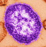 Masernvirus