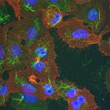 Mit Influenza-A-Virus infizierte humane Lungenkarzinomzellen (Zellkern in blau). Die viralen Proteine Hämagglutinin (grün) und Matrixprotein 2 (rot) befinden sich hauptsächlich an der Plasmamembran.