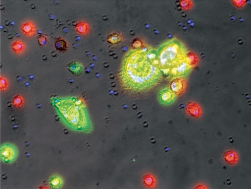 Mit HIV-1 infizierte (gelb-grün) und nicht infizierte Monozyten (rot).  Mit HIV-1 infizierte (gelb-grün) und nicht infizierte Monozyten (rot).