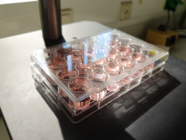 ELISA-Mikrotiterplatte (Quelle: P. Blanco / PEI) ELISA-Mikrotiterplatte (Quelle: P. Blanco / PEI)