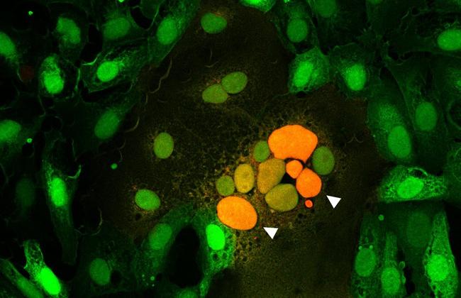 Mikroskopische Aufnahme durch Spikeprotein verschmolzene Zellen. Pfeile zeigen auf eine Zusammenlagerung von Zellkernen (orange) mehrerer verschmolzener Zellen.  Mikroskopische Aufnahme durch Spikeprotein verschmolzene Zellen. Pfeile zeigen auf eine Zusammenlagerung von Zellkernen (orange) mehrerer verschmolzener Zellen.