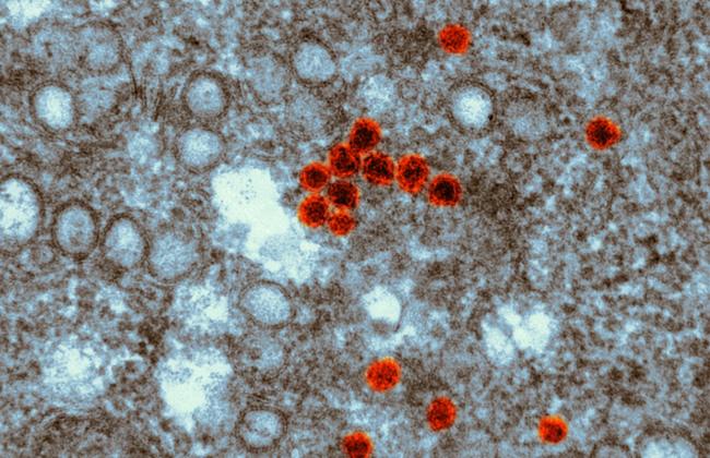 Rasterelektronenmikroskop-Aufnahme Zika-Virus (Quelle: K.Boller/Paul-Ehrlich-Institut)