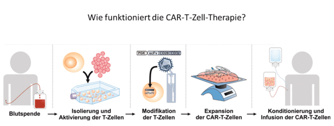 Wie funktioniert die CAR-T-Zell-Therapie?  Wie funktioniert die CAR-T-Zell-Therapie?