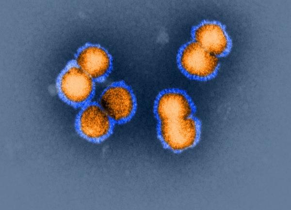 Pandemische Influenza H5N1-Viren (Quelle: K.Boller/Paul-Ehrlich-Institut) (verweist auf: Abteilung Sicherheit von Arzneimitteln und Medizinprodukten)