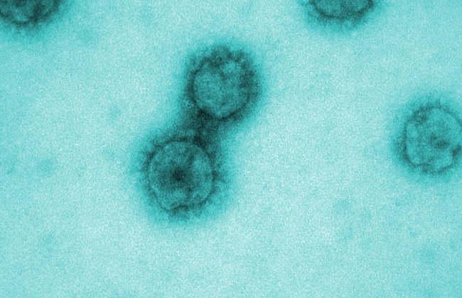 SARS-CoV-2-Viren (Quelle: J.Krijnse Locker/Paul-Ehrlich-Institut)