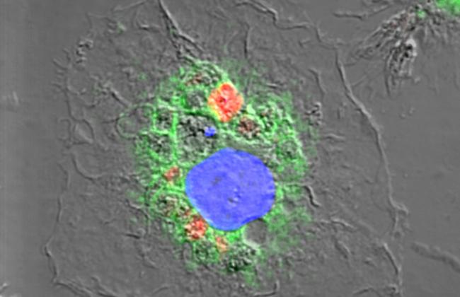Immunologie: Infektion durch Leishmanien Immunologie: Infektion durch Leishmanien