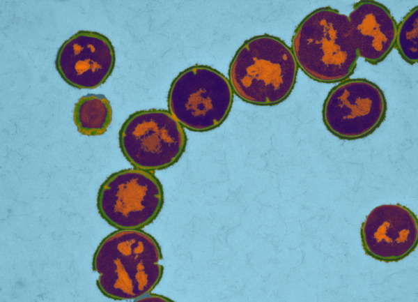 Staphylococcus pyrogenes (Quelle: K.Boller/Paul-Ehrlich-Institut) (verweist auf: Abteilung Mikrobiologie)
