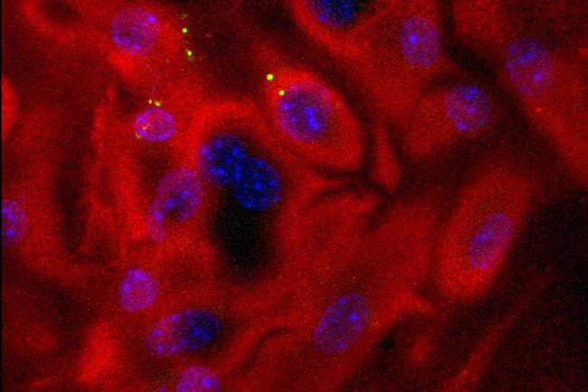 Allergenaufnahme Dendritische Zellen Allergenaufnahme Dendritische Zellen