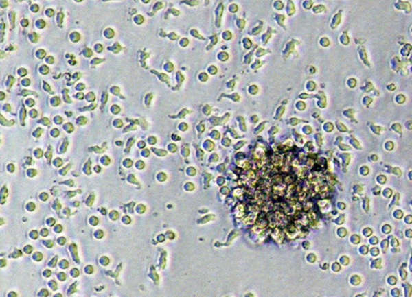 Car-T-Zellen (Quelle: J.Hartmann/PEI) (verweist auf: Forschung beim Präsidenten)