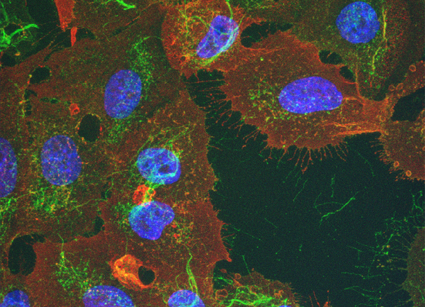 verweist auf: Zelluläre Aspekte von Pathogen-Wirt-Interaktionen Zelluläre Aspekte von Pathogen-Wirt-Interaktionen: Flu-A-Virus (Quelle: Paul-Ehrlich-Institut) (verweist auf: Zelluläre Aspekte von Pathogen-Wirt-Interaktionen)