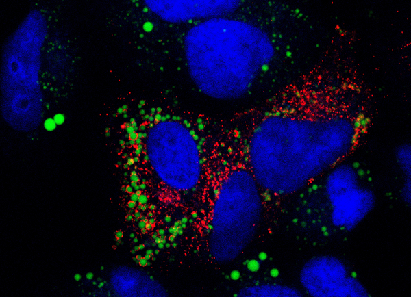 Infektion mit Hepatitis-C-Viren (Quelle: E.Hildt/Paul-Ehrlich-Institut) (verweist auf: Virologie)