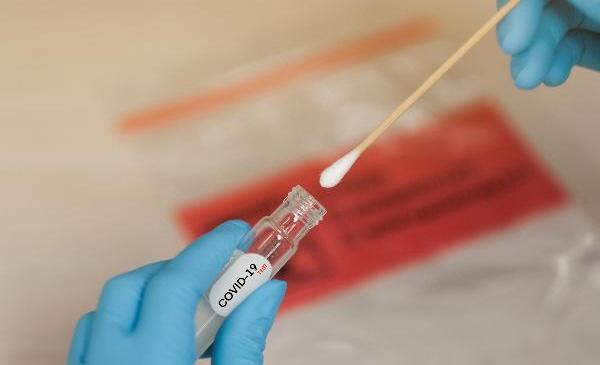 Smear for a COVID-19 Test (Source: Horth Rasur-shutterstock) (refer to: SARS-CoV-2 Test Systems)