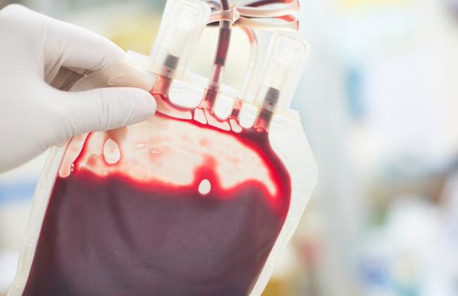 Blood bag (Source: Schira/Shutterstock.com) Blood bag (Source: Schira/Shutterstock.com)