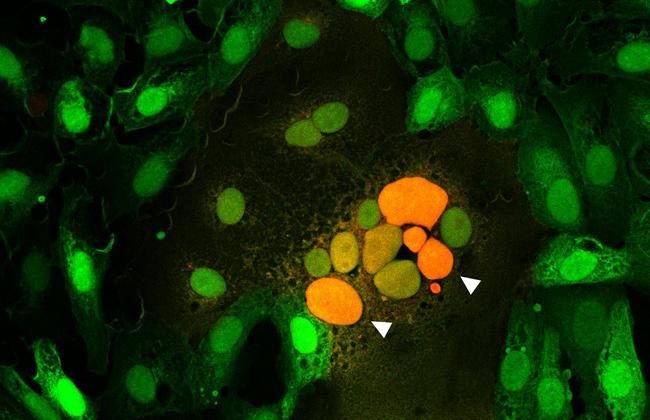 Microscopic  image of cells fused by the spike protein. The arrows point to the attachment of cell cores from several fused cells to each other (orange). 