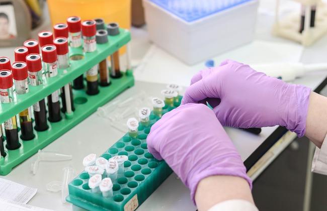 HIV tests in the laboratory (Source: Belova59/Pixabay.com)