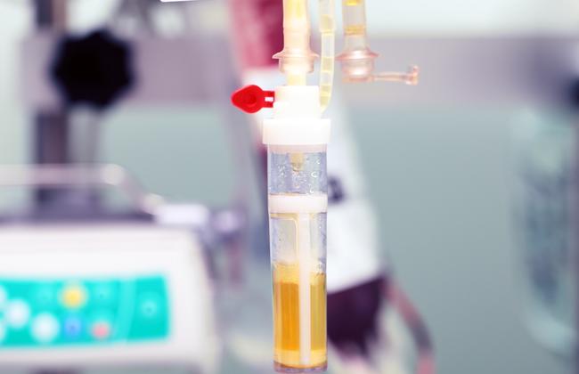 Plasma donation (Source: sfam/shutterstock.com) Plasma donation (Source: sfam/shutterstock.com)