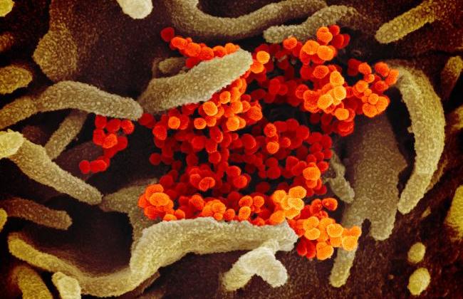 Electron microscopic picture of SARS-Cov-2 corona virus (Source: NIAD)