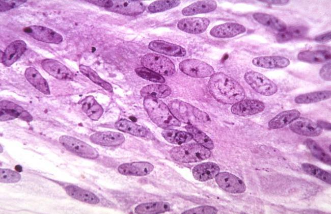 Varicella-Zoster Virus (Source: CDC) Varicella-Zoster Virus (Source: CDC)