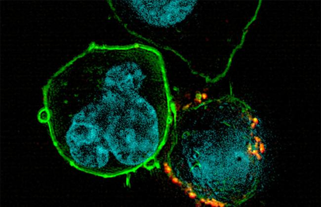 A tumour cell (left: cell core: blue, cell surface: green) is combated by a reprogrammed immune cell (right: synthetic chimeric antigen receptor, CAR: yellow).
