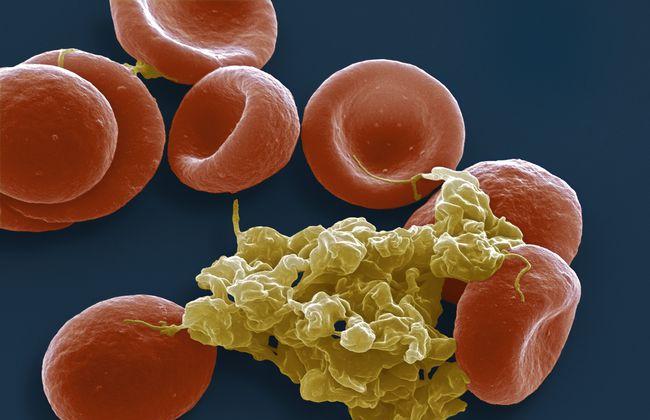 Eryothrocytes / Platelets (Source: Steve Gschmeissner / SciencePhotoLibrary)