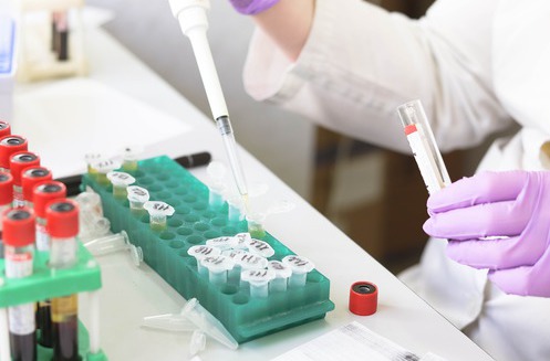Batch Control of Blood Products Batch Control of Blood Products
