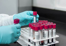 Blood collection tube in the laboratory (Quelle: Pixabay) Blood collection tube in the laboratory (Quelle: Pixabay)