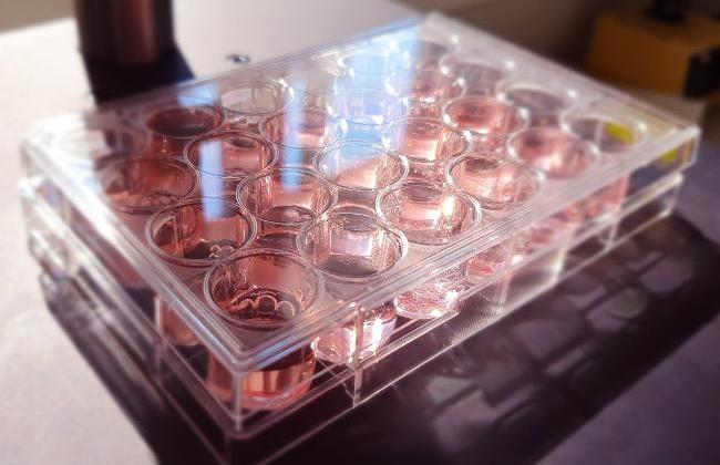 ELISA Microtiter Plate (Source: P. Blanco / PEI) ELISA Microtiter Plate (Source: P. Blanco / PEI)