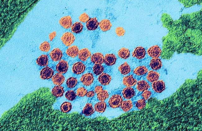 Electron microscope image PERV (Source: Paul-Ehrlich-Institut). Electron microscope image PERV (Source: Paul-Ehrlich-Institut).