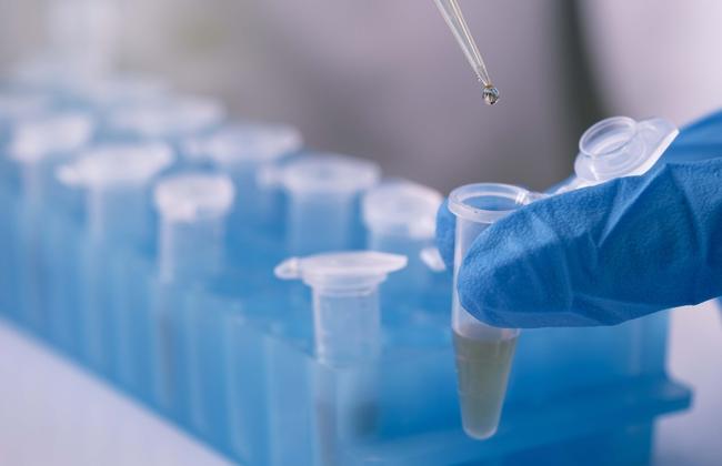 Reference Material / Pipetting in the laboratory with Eppendorf tubes (Source: Jantakorn Kok/Shutterstock.com)
