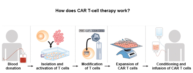 How does CAR T-cell therapy work? How does CAR T-cell therapy work?