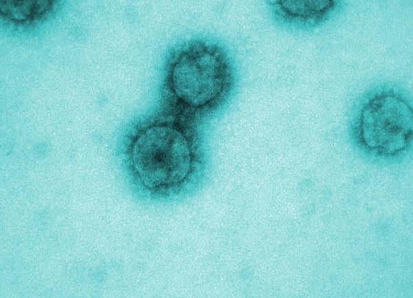 SARS-CoV-2 Virus (Source: J.Krijnse Locker/Paul-Ehrlich-Institut) (refer to: Electron Microscopy of Pathogens)