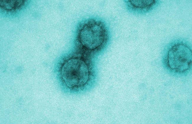 SARS-CoV-2 Virus (Source: J.Krijnse Locker/Paul-Ehrlich-Institut) SARS-CoV-2 Virus (Source: J.Krijnse Locker/Paul-Ehrlich-Institut)
