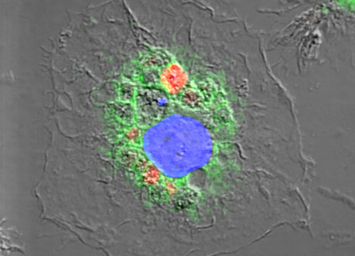 refer to: Immunology Immunology: Infection by Leishmania. (refer to: Immunology)