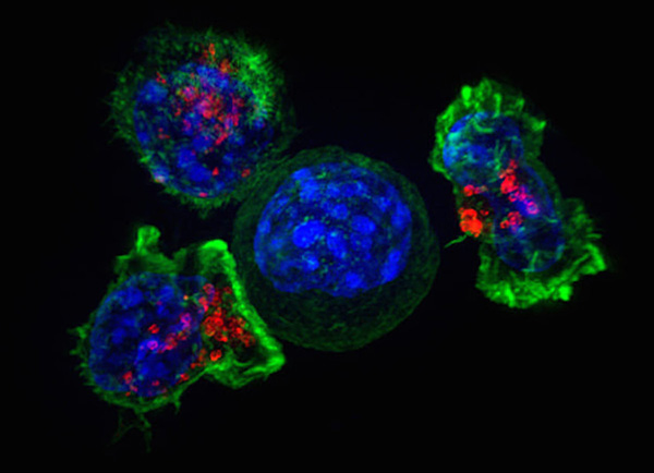 CAR-T Cells sorrounding Cancer Cell (Source: Lippincott-Schwarz/NIH) (refer to: Research Centre 
ATMP / Haematology)